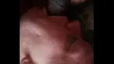 تشغيل نابكلوك منفصل 2 العصب الوجه مع السكتة الدماغية